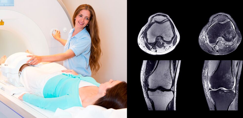 διάγνωση της άρθρωσης του γόνατος