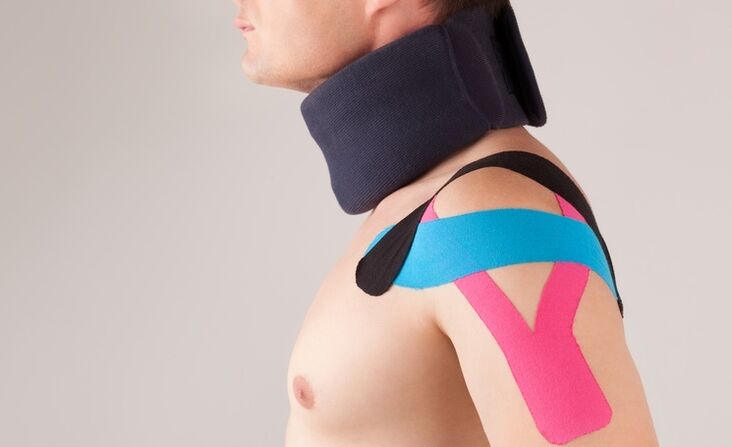 Κατά την οξεία περίοδο της αυχενικής οστεοχονδρωσίας, πρέπει να φοράτε ένα ειδικό κολάρο