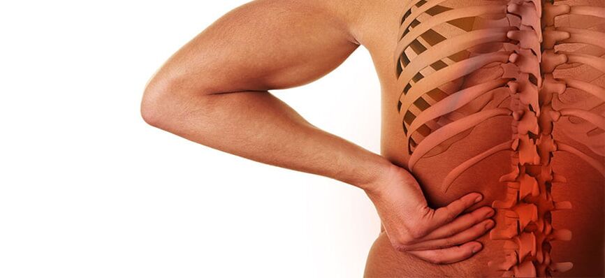 συμπτώματα οσφυϊκής οστεοχόνδρωσης